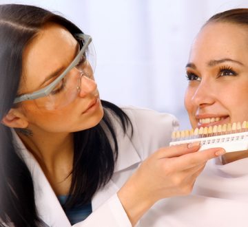 Explaining Dental Veneers And Their Benefits?