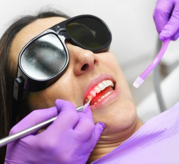 Is Laser Teeth Whitening a Safe Treatment?